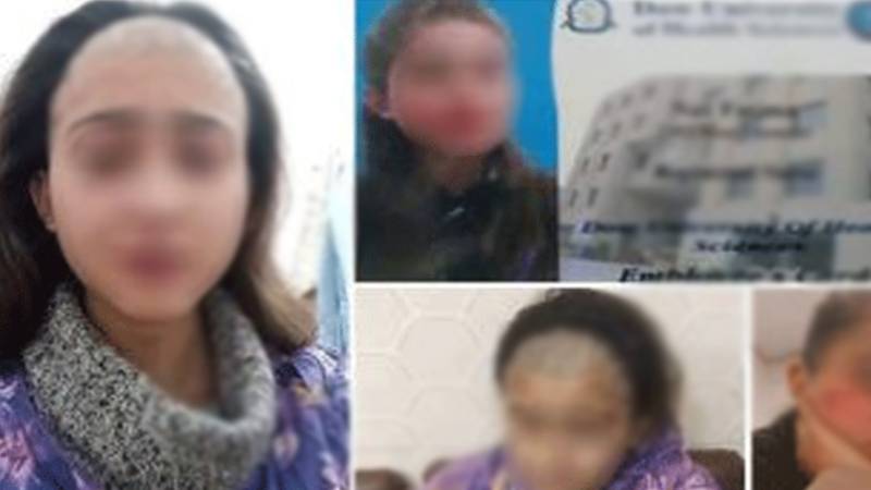 عیسائی دوست سے شادی کی ضد پر والد کا بیٹی پر تشدد، سر کے بال مونڈ دیے