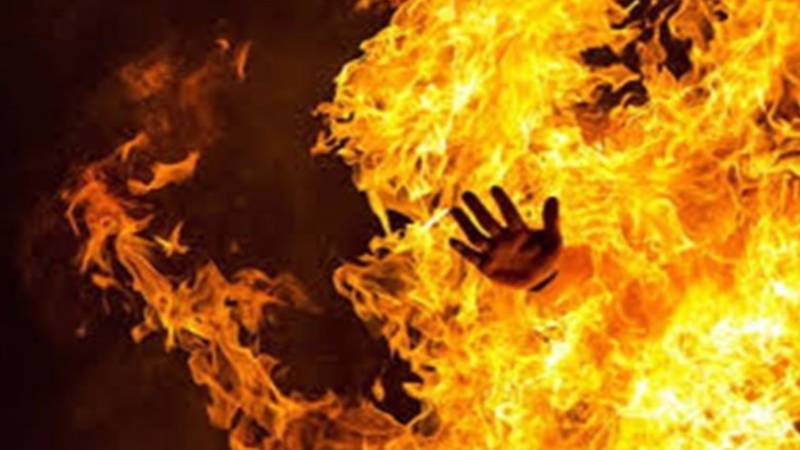 کراچی: گیس لیکیج کے باعث آگ لگنے سے میاں، بیوی اور بچی جھلس گئے
