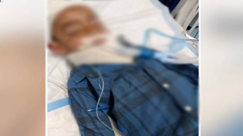 مغلپورہ: اندھی گولی کا شکار 6 سالہ بچہ زندگی اور موت کی کشمکش میں مبتلا