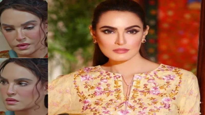 نادیہ حسین کے بدلے چہرے پر سوشل میڈیا پر شدید تنقید، صارفین نے فیلرز اور میک اپ پر سوال اٹھا دیے