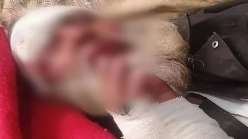 بہاولپور: 85 سالہ بزرگ پر بہیمانہ تشدد، ملزمان نے بیرون ملک مقیم بیٹے کو ویڈیو کال پر ظلم دکھایا