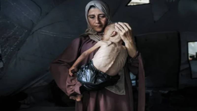 غزہ میں غذائی قلت سے متاثرہ بچوں کی تعداد 28 ہزار سے بڑھ گئی