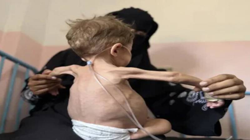 دنیا کی سب سے بڑی علمی انجمن نے اسرائیل کو نسل کشی کا مرتکب قرار دے دیا