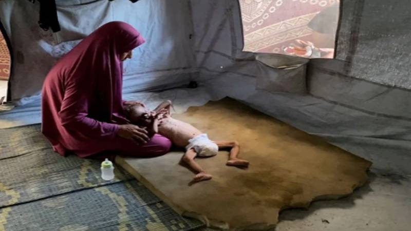 غزہ میں جنگ کے نتیجے میں 21 ہزار بچے معذور، اقوام متحدہ کی رپورٹ
