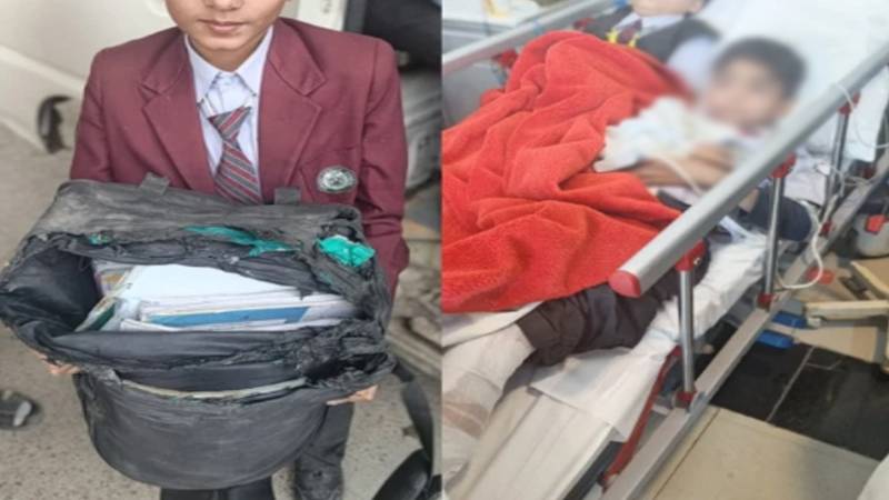 کراچی میں اسکول وین میں آگ لگنے سے 5 بچے زخمی