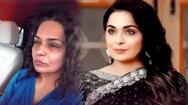 اداکارہ میرا ذہنی دباؤ کے باعث نیویارک کے اسپتال میں زیرِ نگرانی
