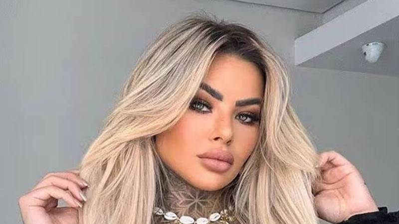 برازیلین انفلوئنسر کی 18 دن بعد کاسمیٹک سرجری سے ہلاکت، اصل وجہ سامنے آ گئی
