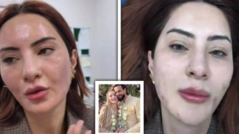 عماد وسیم کی دوسری اہلیہ نائلہ راجہ بغیر میک اپ ویڈیو پر سوشل میڈیا پر ٹرولنگ کی زد میں