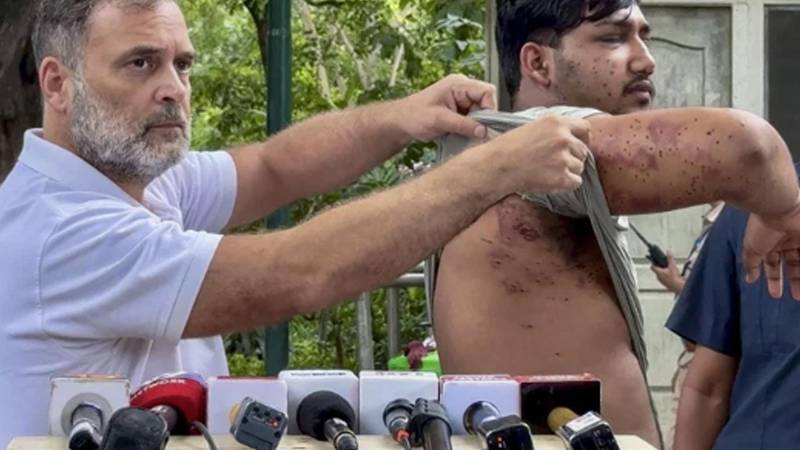 راہول گاندھی کا مودی حکومت پر سنگین الزام، دہلی میں مظاہرین پر پیلٹ گن کے استعمال کا دعویٰ