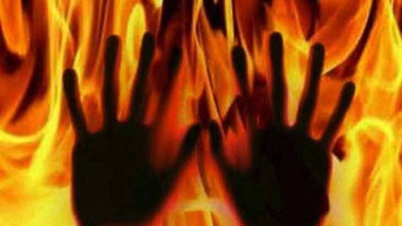 شکارپور میں پراپرٹی تنازع، 10 سالہ بچے پر پٹرول چھڑک کر آگ لگا دی گئی