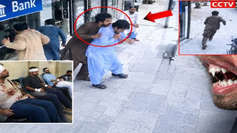 سانگھڑ میں کتے کے کاٹنے سے 4 افراد زخمی، حملہ آور کتا فرار