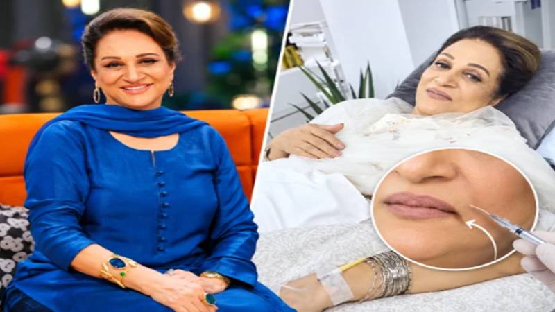 بوٹوکس کے بعد چہرے کا ایک حصہ خراب ہو گیا تھا، بشریٰ انصاری 